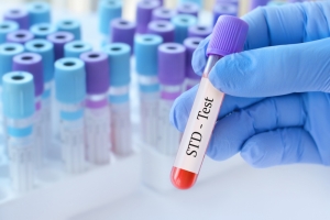 STD Test at Home Dubai – Private, Professional & Reliable Health Screening