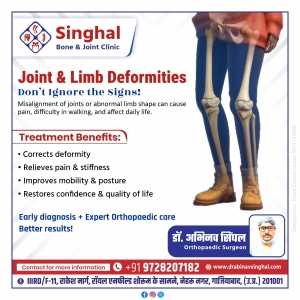 Joint & Limb Deformities: Causes, Consequences, and the Path to Recovery