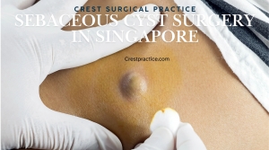 Dealing with Painful Skin Lumps: When Surgery Becomes Necessary