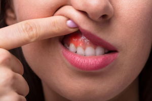 Gum Infection Treatment at Home: Simple Ways to Ease Pain and Protect Your Smile