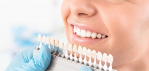 Dental Veneers in Islamabad: The Ultimate Smile Solution