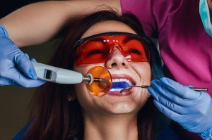 How Teeth Whitening in Beverly Hills Can Transform Your Look