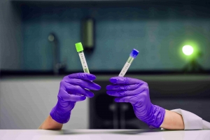 How Sarcoidosis Patient Samples Are Advancing Diagnostic and Therapeutic Discoveries