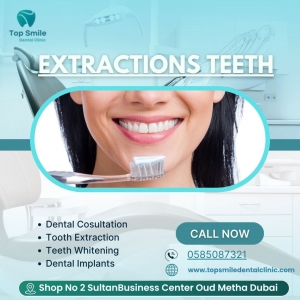 Safe & Painless Extractions Teeth in Dubai – Top Smile Dental Clinic