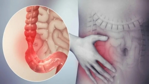 What is Functional Abdominal Pain (FAP)?