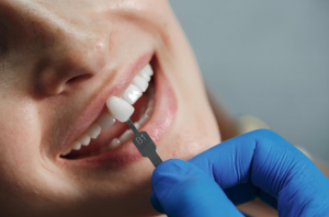 How to Care for Your Dental Crowns and Bridges