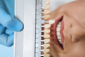 What Is the Process of Getting Porcelain Veneers in Brooklyn?