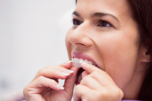 How Invisalign Is Changing Orthodontics for Cheshire Teens and Adults