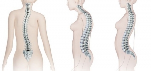 Understanding Spine Deformities: Causes, Care, and Hope