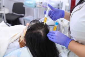 Maintaining Healthy Hair After PRP Hair Treatment Sessions