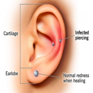 Conch Piercing Insights