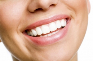 Teeth Whitening Pros and Cons: The Ultimate Guide