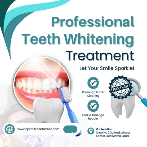 Brighten Your Smile with Professional Teeth Whitening at Top Smile Dental Clinic
