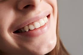 What Causes Gum Discoloration in the First Place?