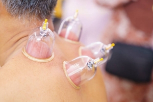 The Science Behind Hijama Treatment