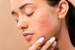 Common Skin Issues in Guam and How Dermatologists Treat Them