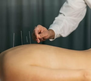 How Acupuncture and Massage Therapy Work Together for Back Pain