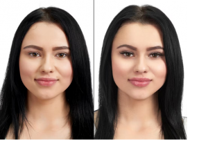 Flourishing Confidence: Female Hair Transplant Before and After Stories