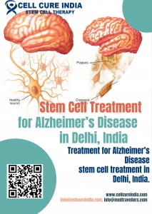 Stem Cell Treatment for Alzheimer’s Disease