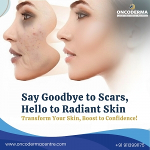 Comprehensive Dental, Skin & Cancer Care in Bagaluru – OncoDerma Centre.com