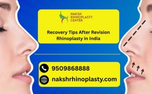 Recovery Tips After Revision Rhinoplasty in India