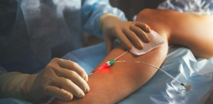 How Vascular Surgery in Dubai Can Save Lives and Restore Circulation