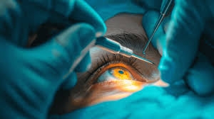 Ophthalmology Surgery in India: Restoring Vision with World-Class Precision