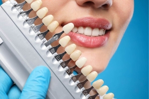 Dental Veneers Cost That Make Every Smile Look Perfect and Stunning