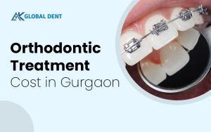 How Braces Work to Straighten Teeth?
