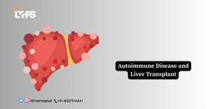 Autoimmune Disease and Liver Transplant