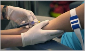 Get Tested Without Leaving Home: 10 Benefits of Blood Test Home Collection in Gurgaon