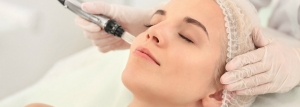 Achieve Radiant, Smooth Skin with Dermapen Skin Needling Sydney