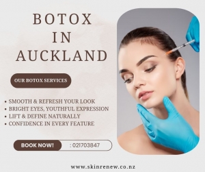 Botox in Auckland | Smooth Fine Lines the Gentle Way at Skin Renew