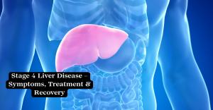 Stage 4 Liver Disease – Symptoms, Treatment & Recovery