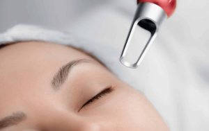 PicoSure Laser Treatment: soft, effective, skin‑smoothing solution