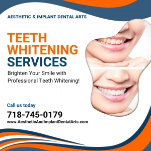 What is the Best Teeth Whitening Treatment?