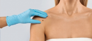 Can Skin Tag Removal in Dubai Be Painless?