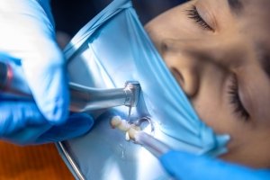 Is a Root Canal Painful? What You Need to Know About Root Canal Treatments