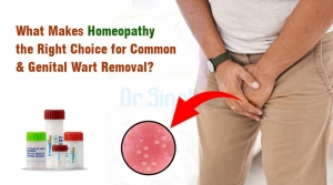 Homeopathic Treatment for Genital Warts: A Comprehensive Approach to HPV Management
