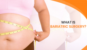 What is Bariatric surgery?