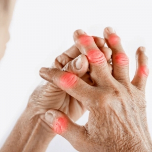  Gout Treatment Options in Wardha 