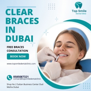 Clear Braces in Dubai – Get a Perfect Smile with Top Smile Dental Clinic