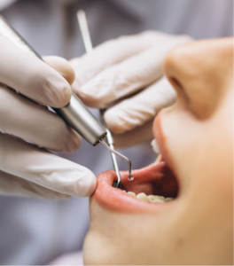 Affordable Dental Services That Don’t Compromise on Quality