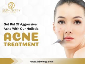 Advanced Acne & Rosacea Treatment in Indore for Clear, Healthy, and Balanced Skin