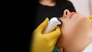 How Can Laser Treatments Transform Your Skin in Toronto?