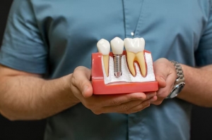 How Dental Implants in Westport Can Restore Your Smile