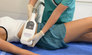 CoolSculpting Offers Precise Contouring for Smooth Curves