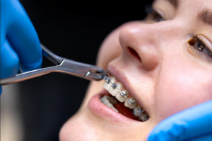 Orthodontist in Leamington Spa: How Specialist Care Ensures Perfect Alignment
