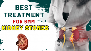 Best Treatment for 6mm Kidney Stones