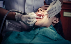 Painless Root canal treatment in Ahmedabad